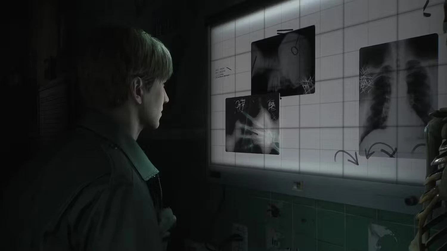 Silent Hill 2 Remake Introduces Nostalgic Throwback Feature