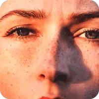 Get Rid Dark Spot On Skin icon